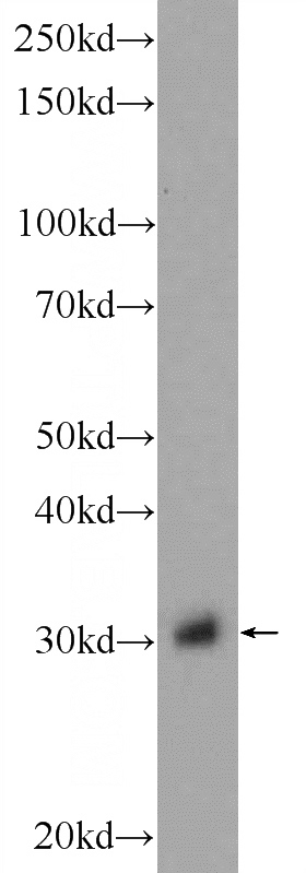 rat kidney tissue were subjected to SDS PAGE followed by western blot with Catalog No:111009(GNPDA2 Antibody) at dilution of 1:600