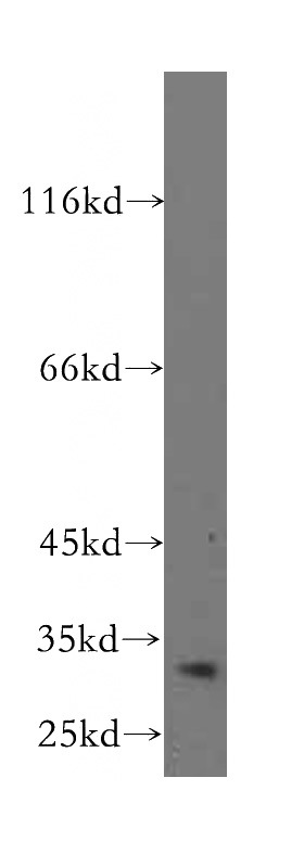 mouse ovary tissue were subjected to SDS PAGE followed by western blot with Catalog No:108387(BCL10 antibody) at dilution of 1:500