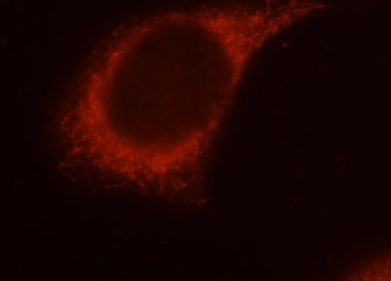 Immunofluorescent analysis of MCF-7 cells, using PIGO antibody Catalog No:113895 at 1:25 dilution and Rhodamine-labeled goat anti-rabbit IgG (red).