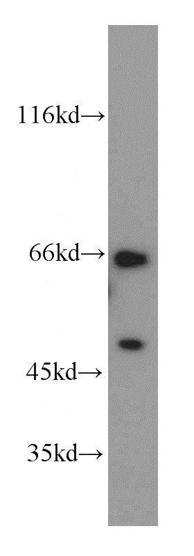 HEK-293 cells were subjected to SDS PAGE followed by western blot with Catalog No:113043(NCOA5 antibody) at dilution of 1:600