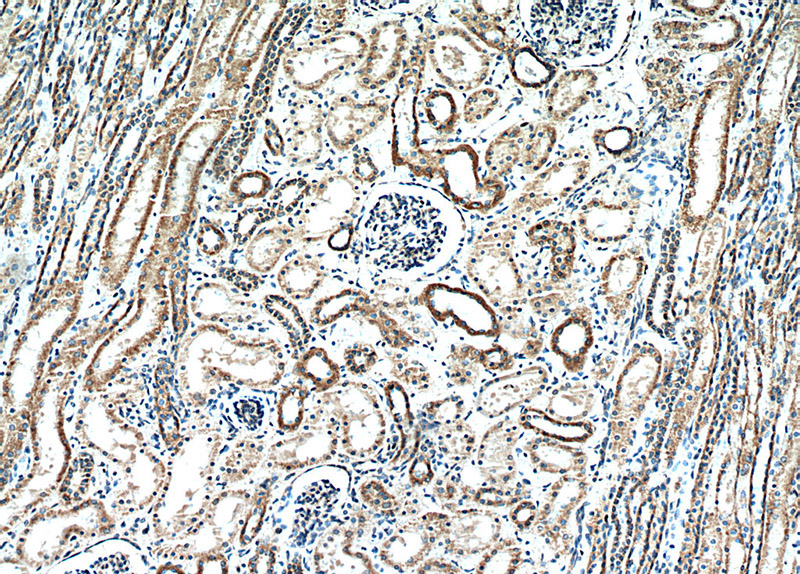 Immunohistochemical of paraffin-embedded human kidney using Catalog No:115970(CCDC44 antibody) at dilution of 1:50 (under 10x lens)
