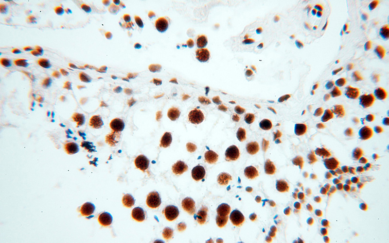 Immunohistochemical of paraffin-embedded human testis using Catalog No:114973(SART3 antibody) at dilution of 1:100 (under 40x lens)