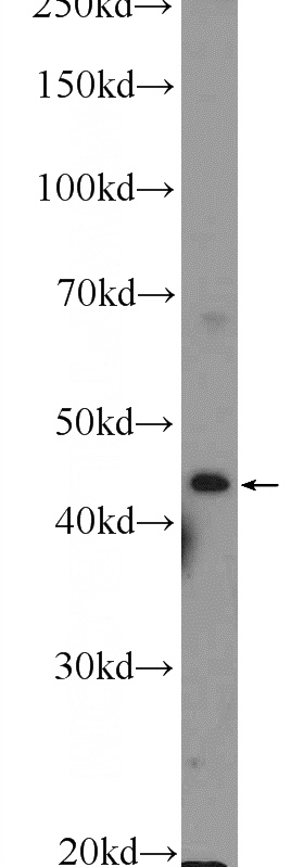 HEK-293 cells were subjected to SDS PAGE followed by western blot with Catalog No:114700(RILP Antibody) at dilution of 1:300