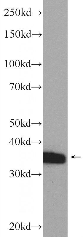 mouse ovary tissue were subjected to SDS PAGE followed by western blot with Catalog No:110038(DTX3 Antibody) at dilution of 1:600
