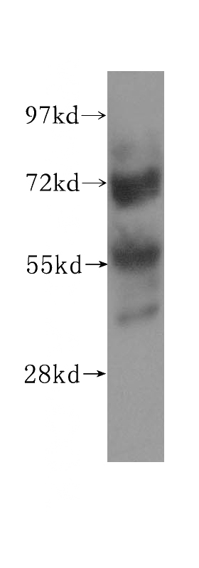 HeLa cells were subjected to SDS PAGE followed by western blot with Catalog No:117152(ZNF266 antibody) at dilution of 1:500