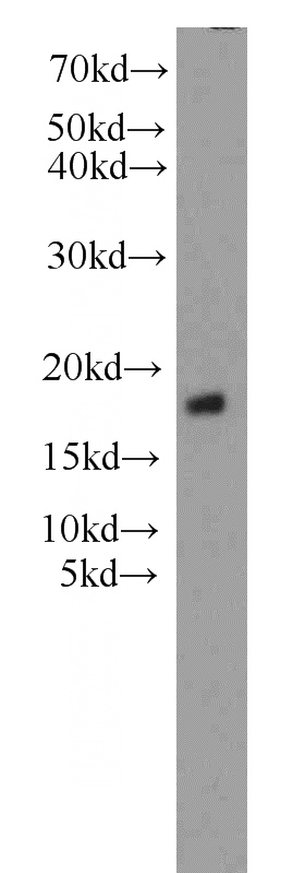 A549 cells were subjected to SDS PAGE followed by western blot with Catalog No:115590(SRP14 antibody) at dilution of 1:800