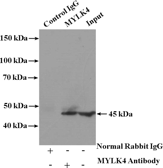 IP Result of anti-MYLK4 (IP:Catalog No:112975, 4ug; Detection:Catalog No:112975 1:500) with HEK-293 cells lysate 3600ug.