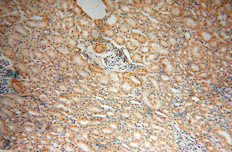 Immunohistochemical of paraffin-embedded human kidney using Catalog No:114286(Prx5 antibody) at dilution of 1:50 (under 10x lens)