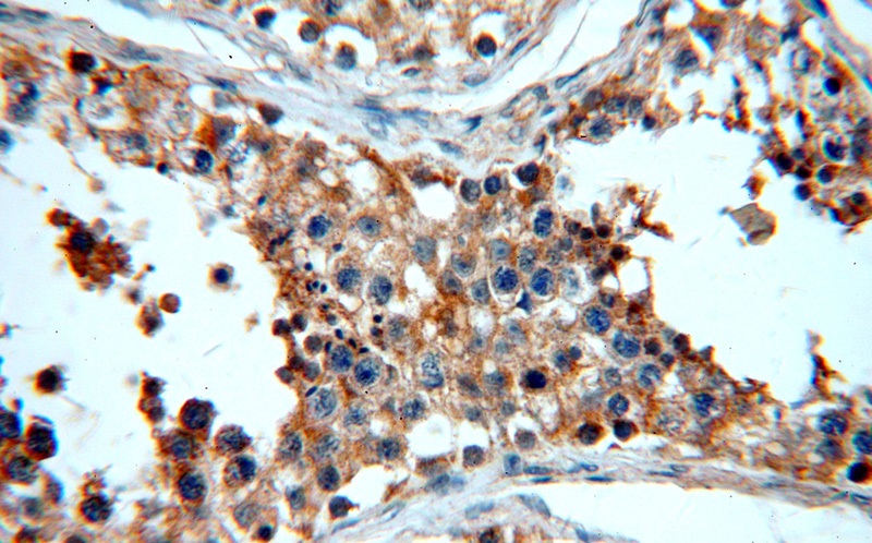 Immunohistochemical of paraffin-embedded human testis using Catalog No:115304(SLC16A12 antibody) at dilution of 1:50 (under 40x lens)