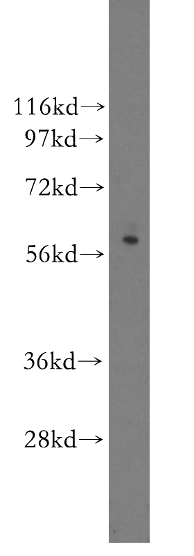 Jurkat cells were subjected to SDS PAGE followed by western blot with Catalog No:111160(GZMA antibody) at dilution of 1:600