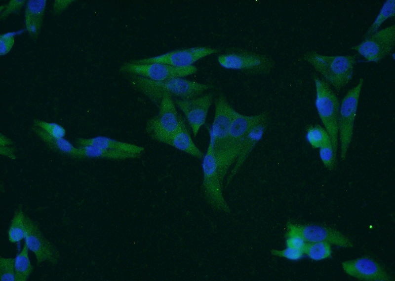 Immunofluorescent analysis of A375 cells using Catalog No:112377(MAGEA1 Antibody) at dilution of 1:50 and Alexa Fluor 488-congugated AffiniPure Goat Anti-Rabbit IgG(H+L)