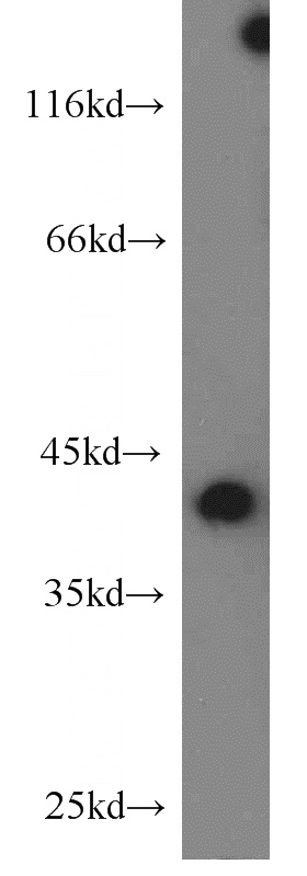 K-562 cells were subjected to SDS PAGE followed by western blot with Catalog No:112444(MAPRE2 antibody) at dilution of 1:500
