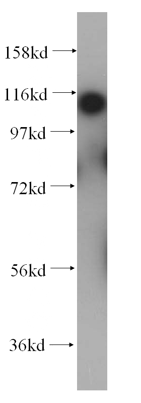 HeLa cells were subjected to SDS PAGE followed by western blot with Catalog No:111434(HLTF antibody) at dilution of 1:300