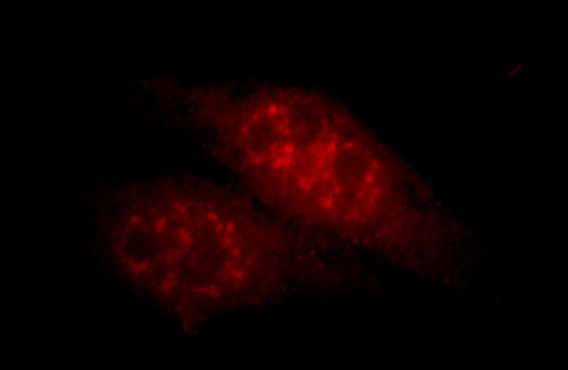 Immunofluorescent analysis of Hela cells, using HEYL antibody Catalog No:111310 at 1:25 dilution and Rhodamine-labeled goat anti-rabbit IgG (red).