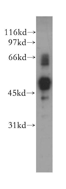 A375 cells were subjected to SDS PAGE followed by western blot with Catalog No:115724(STK38L antibody) at dilution of 1:400