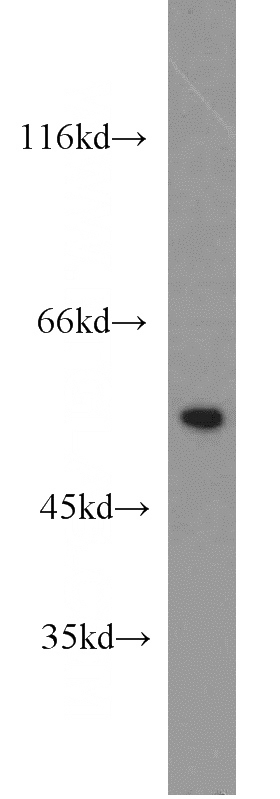 mouse heart tissue were subjected to SDS PAGE followed by western blot with Catalog No:114260(PTBP2 antibody) at dilution of 1:1000