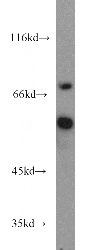 Jurkat cells were subjected to SDS PAGE followed by western blot with Catalog No:114033(POLM antibody) at dilution of 1:800
