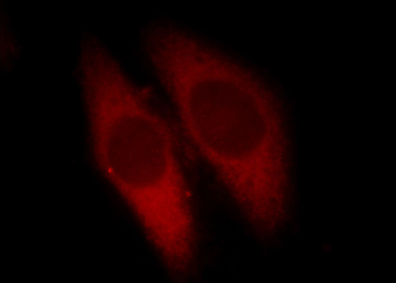 Immunofluorescent analysis of Hela cells, using CAPN1 antibody Catalog No:108833 at 1:25 dilution and Rhodamine-labeled goat anti-rabbit IgG (red).