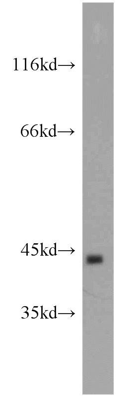 COLO 320 cells were subjected to SDS PAGE followed by western blot with Catalog No:117339(TBP antibody) at dilution of 1:1000