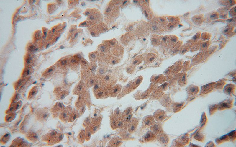 Immunohistochemical of paraffin-embedded human liver using Catalog No:113085(NDUFS7 antibody) at dilution of 1:100 (under 40x lens)