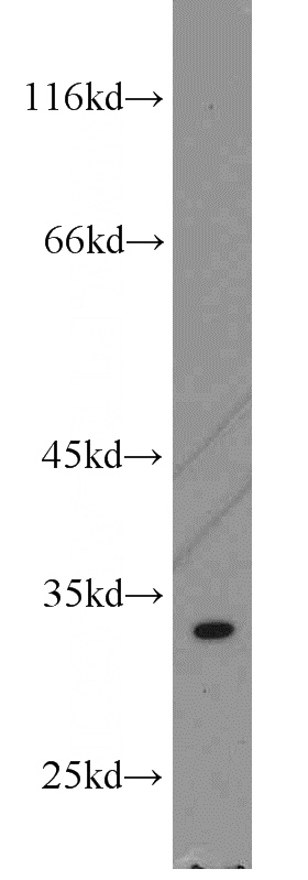 K-562 cells were subjected to SDS PAGE followed by western blot with Catalog No:116058(THTPA antibody) at dilution of 1:800