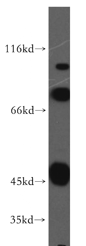 COLO 320 cells were subjected to SDS PAGE followed by western blot with Catalog No:114992(SCFD2 antibody) at dilution of 1:200