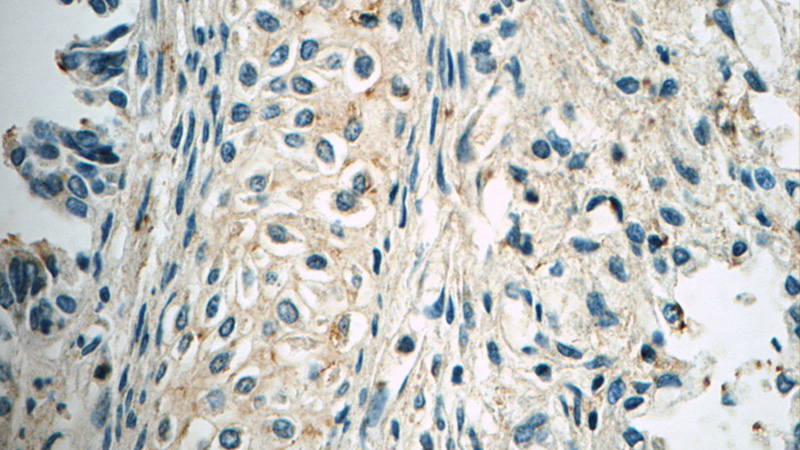 Immunohistochemistry of paraffin-embedded human lung tissue slide using Catalog No:109376(COL2A1 Antibody) at dilution of 1:50 (under 40x lens)