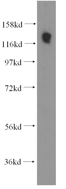 A549 cells were subjected to SDS PAGE followed by western blot with Catalog No:115025(SDCCAG1 antibody) at dilution of 1:500