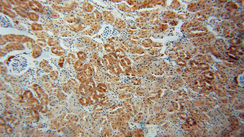 Immunohistochemical of paraffin-embedded human kidney using Catalog No:111707(TRMT2A antibody) at dilution of 1:50 (under 10x lens)