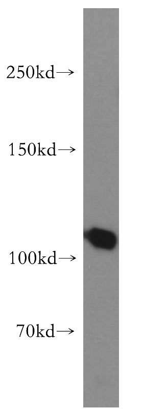 human liver tissue were subjected to SDS PAGE followed by western blot with Catalog No:115849(TAOK3 antibody) at dilution of 1:800