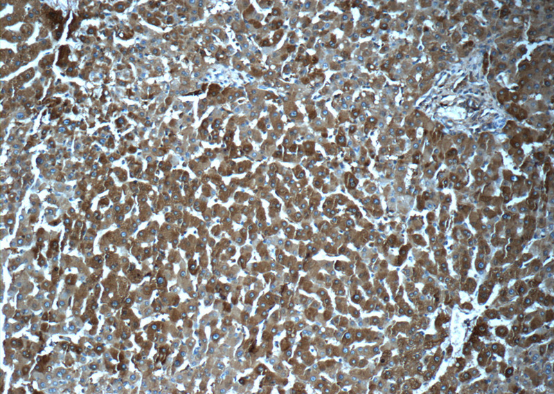 Immunohistochemistry of paraffin-embedded human liver tissue slide using Catalog No:110622(FTL Antibody) at dilution of 1:50 (under 10x lens)