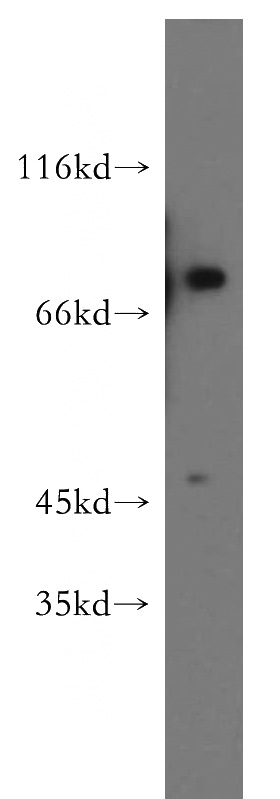K-562 cells were subjected to SDS PAGE followed by western blot with Catalog No:109837(DDX51 antibody) at dilution of 1:300