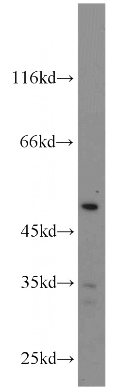 mouse testis tissue were subjected to SDS PAGE followed by western blot with Catalog No:116294(TNFSF13B antibody) at dilution of 1:1000