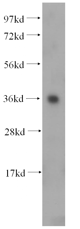 human kidney tissue were subjected to SDS PAGE followed by western blot with Catalog No:109473(COQ9 antibody) at dilution of 1:500