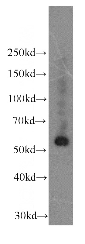L02 cells were subjected to SDS PAGE followed by western blot with Catalog No:107212(FGG Antibody) at dilution of 1:1000