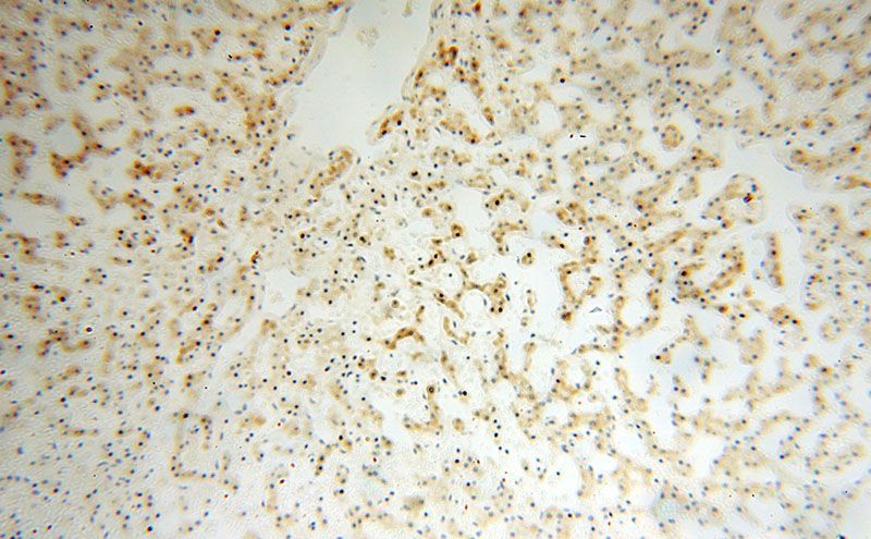 Immunohistochemical of paraffin-embedded human liver using Catalog No:109461(CPOX antibody) at dilution of 1:100 (under 10x lens)