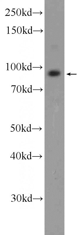HeLa cells were subjected to SDS PAGE followed by western blot with Catalog No:116180(C2CD2L Antibody) at dilution of 1:1000