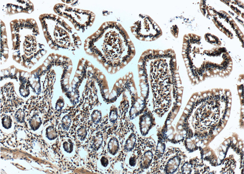 Immunohistochemistry of paraffin-embedded human small intestine tissue slide using Catalog No:107393(IL22RA2 Antibody) at dilution of 1:50 (under 10x lens)