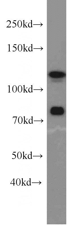 Jurkat cells were subjected to SDS PAGE followed by western blot with Catalog No:109905(DGCR8 antibody) at dilution of 1:800