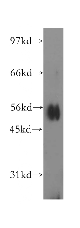 Jurkat cells were subjected to SDS PAGE followed by western blot with Catalog No:111821(IPPK antibody) at dilution of 1:300