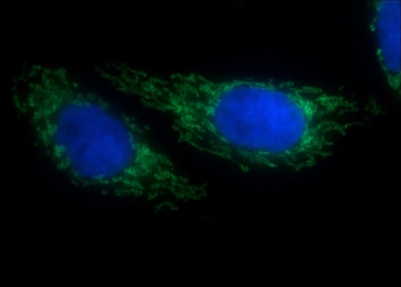 Immunofluorescent analysis of HepG2 cells using Catalog No:115320 (SLC25A1 Antibody) at dilution of 1:50 and Alexa Fluor 488-congugated AffiniPure Goat Anti-Rabbit IgG(H+L)