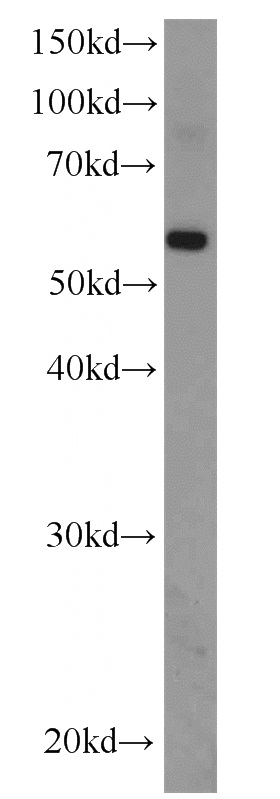 mouse kidney tissue were subjected to SDS PAGE followed by western blot with Catalog No:110206(EFEMP2 antibody) at dilution of 1:500