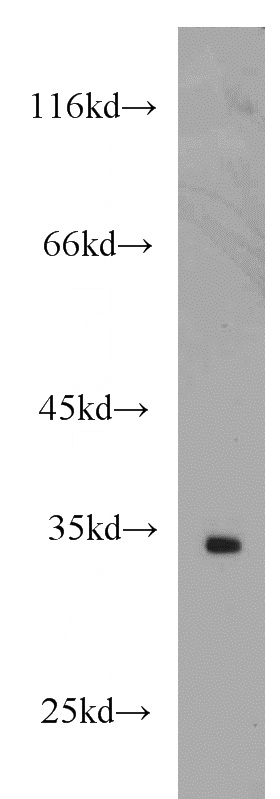 mouse brain tissue were subjected to SDS PAGE followed by western blot with Catalog No:107878(NAPA antibody) at dilution of 1:500
