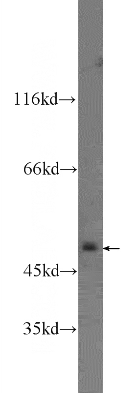 MCF-7 cells were subjected to SDS PAGE followed by western blot with Catalog No:112027(KDM4A Antibody) at dilution of 1:300