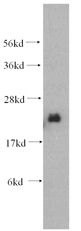 mouse ovary tissue were subjected to SDS PAGE followed by western blot with Catalog No:113076(NDUFB7 antibody) at dilution of 1:500