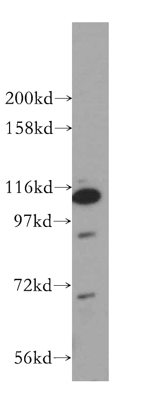 Y79 cells were subjected to SDS PAGE followed by western blot with Catalog No:112014(KIF3C antibody) at dilution of 1:800