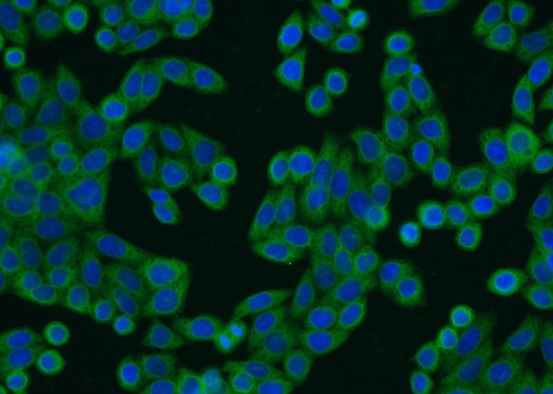 Immunofluorescent analysis of HeLa cells using Catalog No:110395(EPS8L2 Antibody) at dilution of 1:25 and Alexa Fluor 488-congugated AffiniPure Goat Anti-Rabbit IgG(H+L)