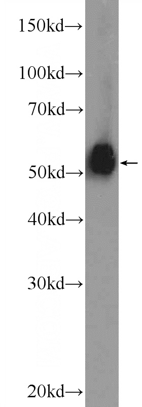 NIH/3T3 cells were subjected to SDS PAGE followed by western blot with Catalog No:110474(ESR2 Antibody) at dilution of 1:2000