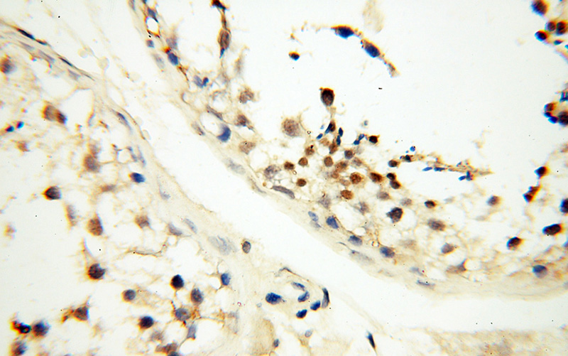 Immunohistochemical of paraffin-embedded human testis using Catalog No:110078(POLB antibody) at dilution of 1:100 (under 40x lens)