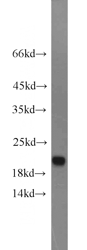 mouse liver tissue were subjected to SDS PAGE followed by western blot with Catalog No:109717(CDO1 antibody) at dilution of 1:600